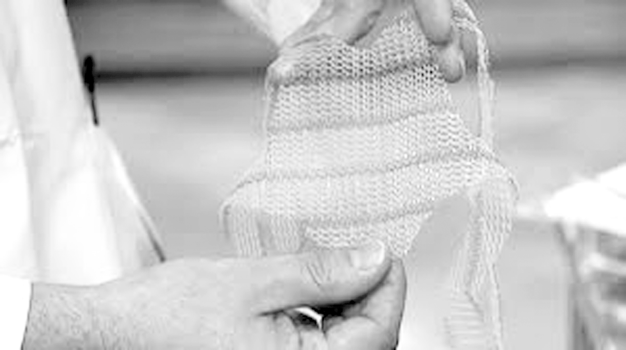 Surgical mesh 031119 New Orleans Multicultural News Source The